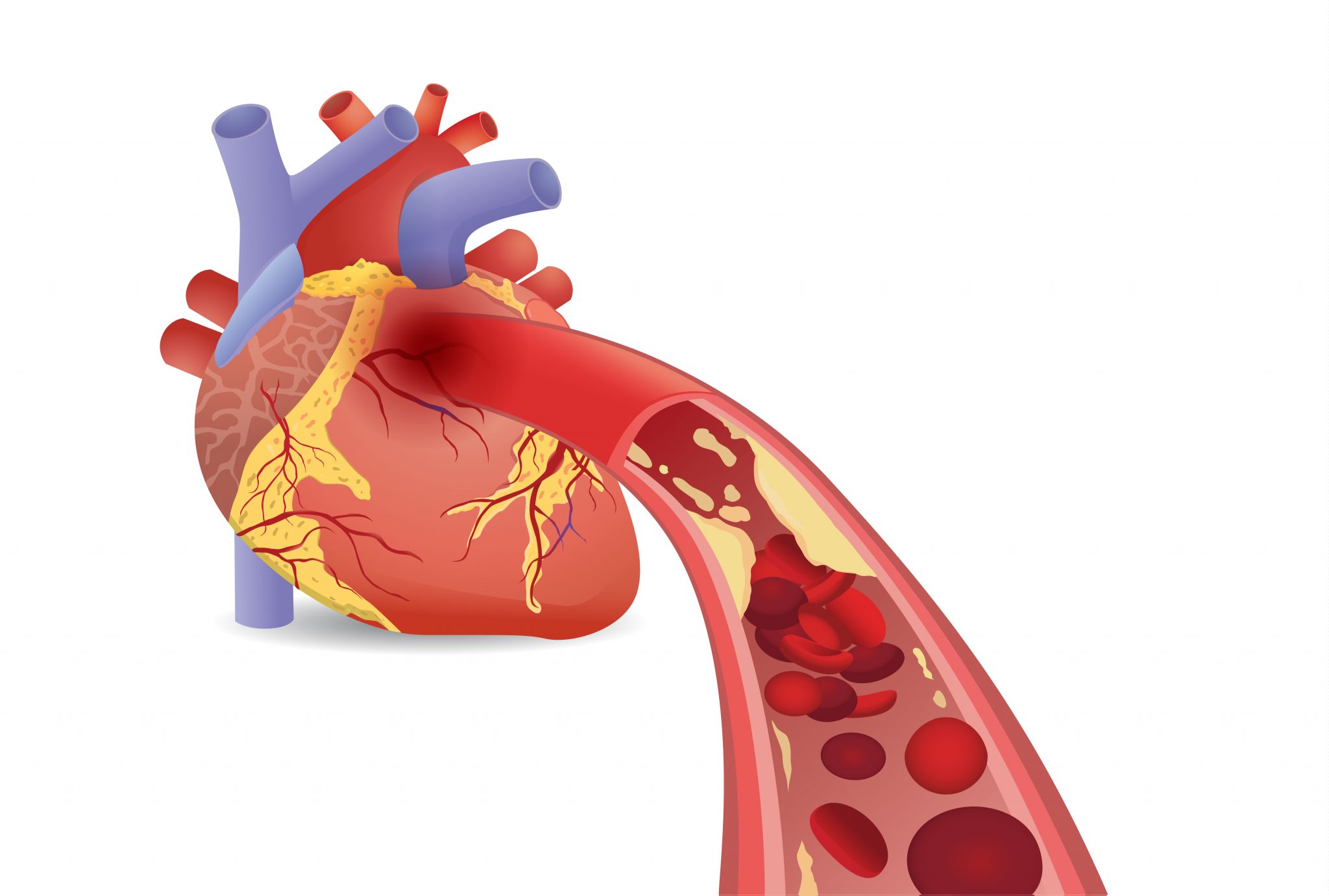 Cardiovascular Clip Art