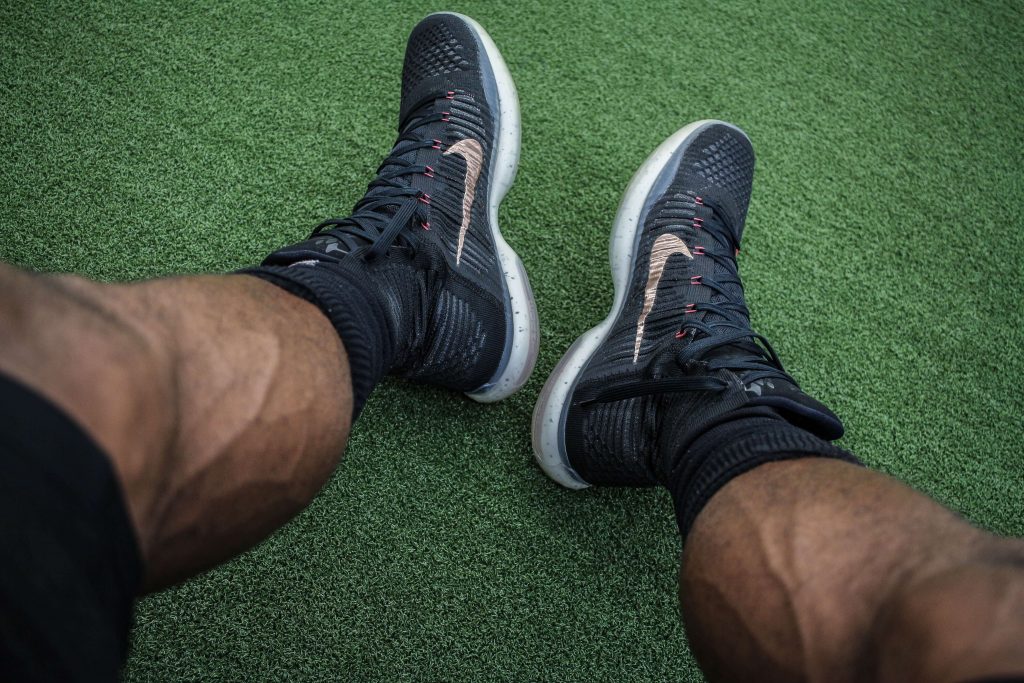 Deep Vein Thrombosis -spider veins-sclerotherapy-treatment-south-florida-cardiovascular-specialists-1-1