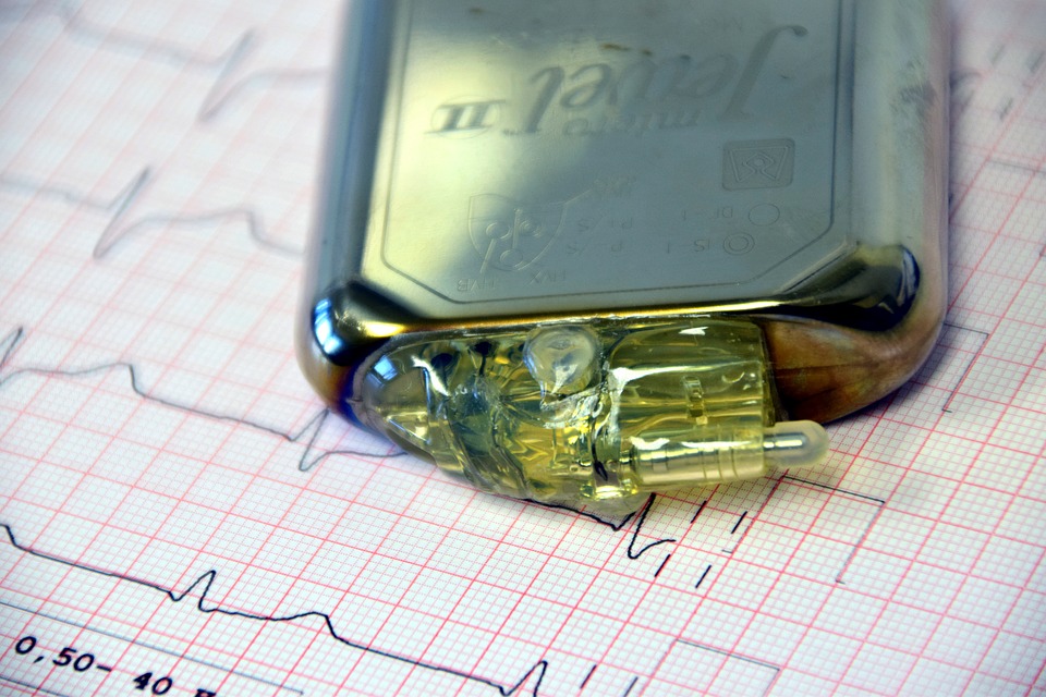 What Is A Cardiac Pacemaker And Who Needs It?