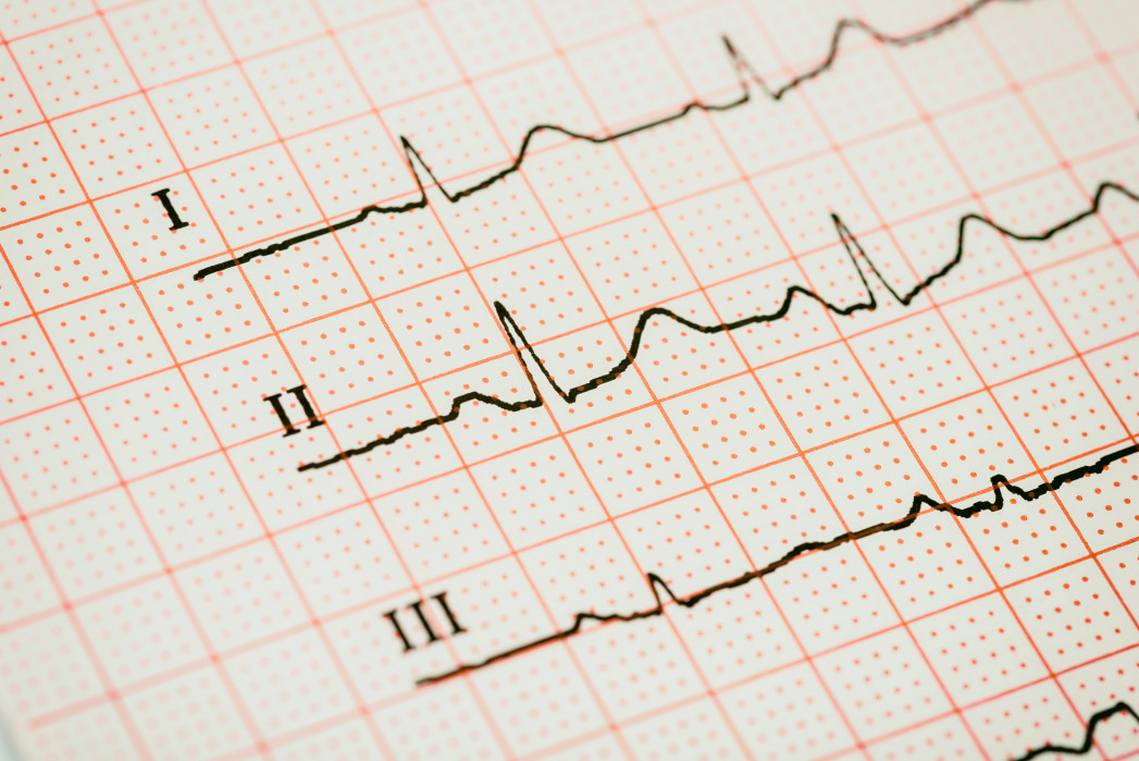 Is Heart Rhythm Important? Here Is Your Guide On How to Check it