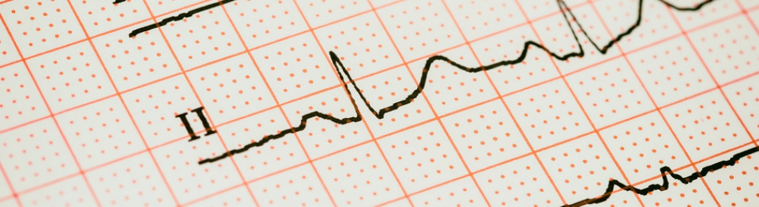 Is Heart Rhythm Important? Here Is Your Guide On How to Check it